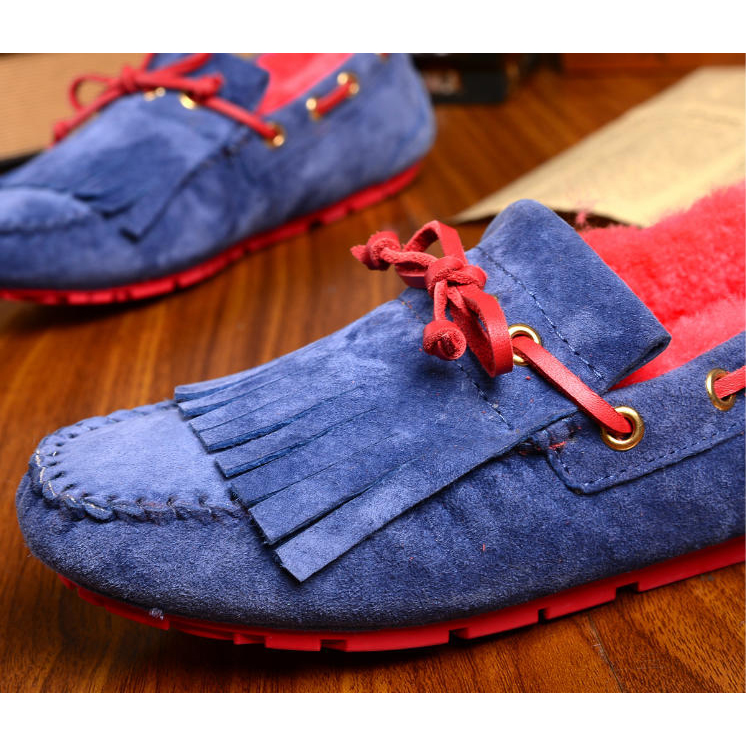 2015 UGG women Plush casual shoes